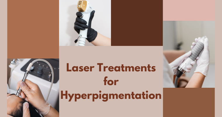 Laser Treatments for Hyperpigmentation